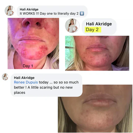 Hali Akridge Day 1 to Day 2 results