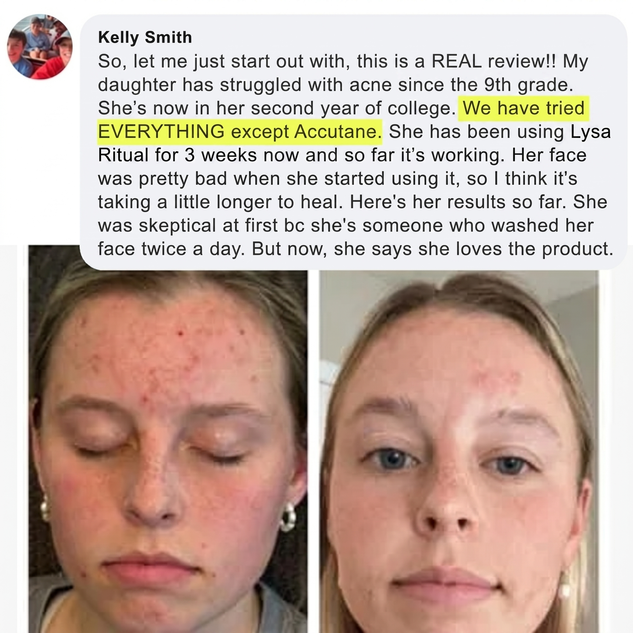 Kelly Smith review with before and after photos