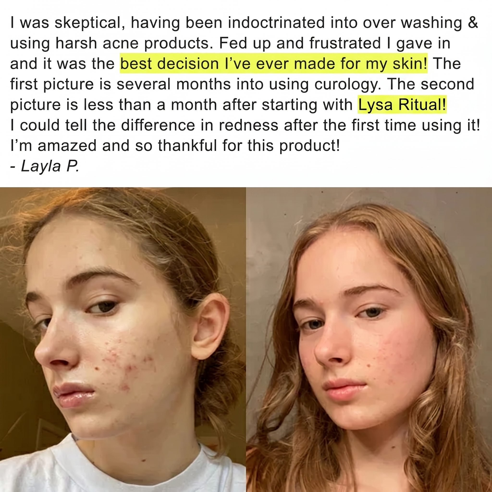 Layla P. before and after review